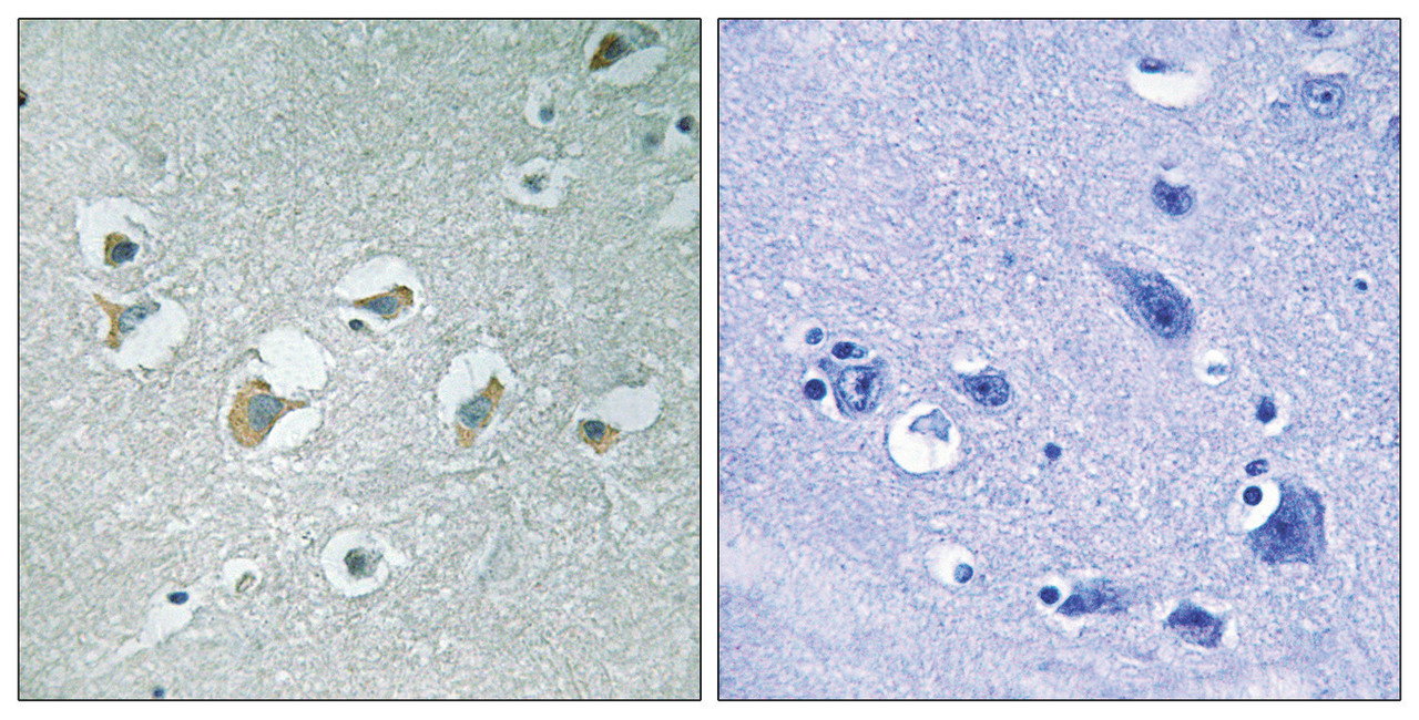 Immunohistochemical analysis of paraffin-embedded human brain tissue using MLK1/2 (Phospho-Thr312/266) antibody (left) or the same antibody preincubated with blocking peptide (right) .