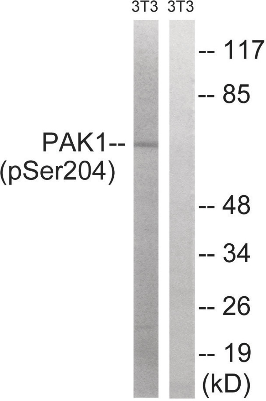 Western blot analysis of extracts from 3T3 cells treated with UV using PAK1 (Phospho-Ser204) Antibody. The lane on the right is treated with the antigen-specific peptide.