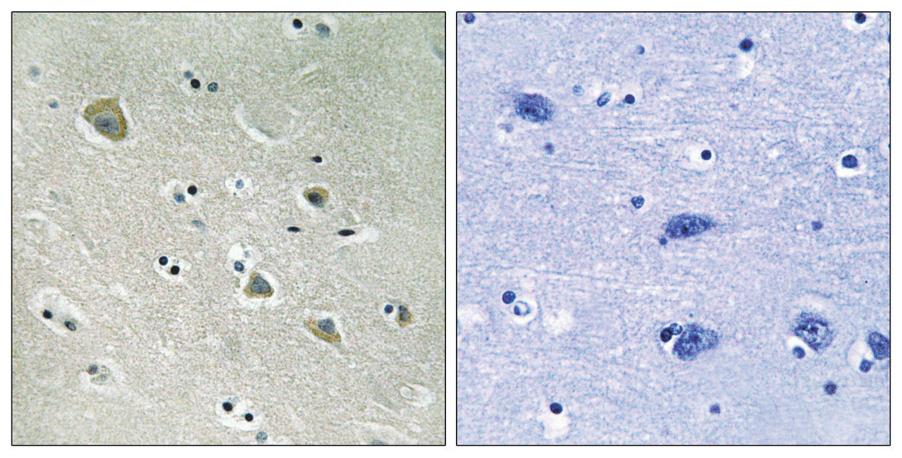 Immunohistochemical analysis of paraffin-embedded human brain tissue using PAK1 (Phospho-Ser204) antibody (left) or the same antibody preincubated with blocking peptide (right) .