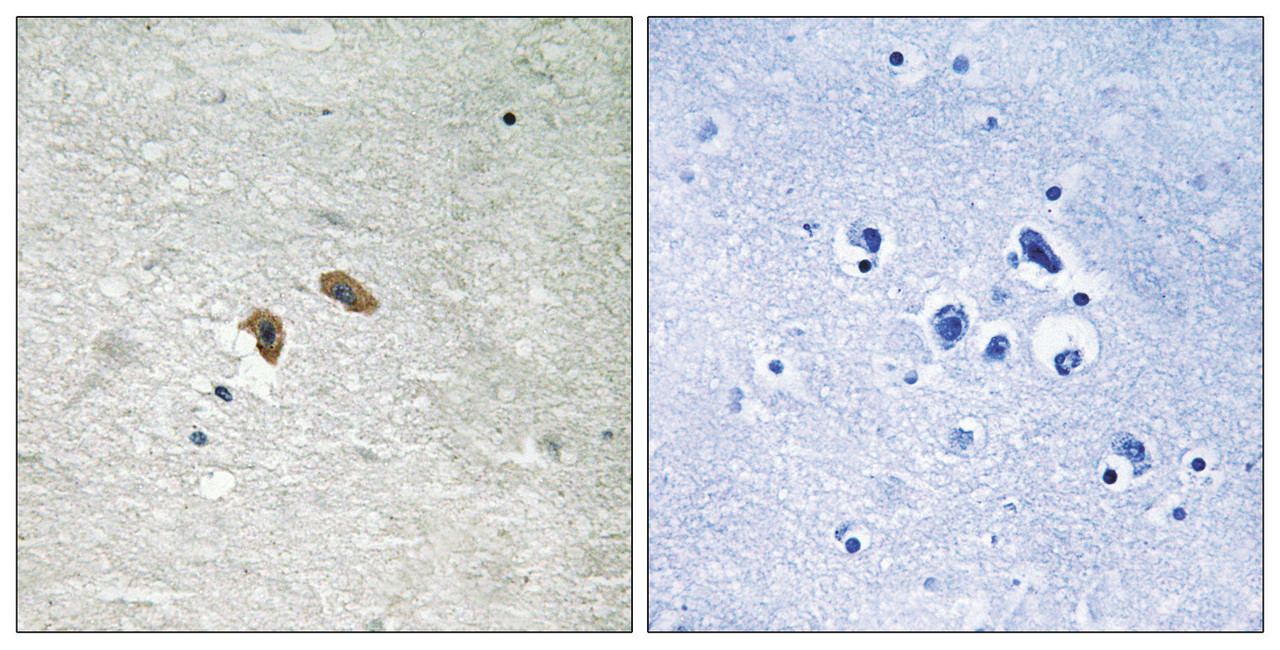 Immunohistochemical analysis of paraffin-embedded human brain tissue using C-RAF (Phospho-Thr269) antibody (left) or the same antibody preincubated with blocking peptide (right) .