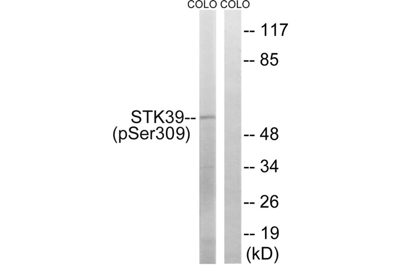 Western blot analysis of extracts from COLO cells using STK39 (Phospho-Ser309) Antibody. The lane on the right is treated with the antigen-specific peptide.