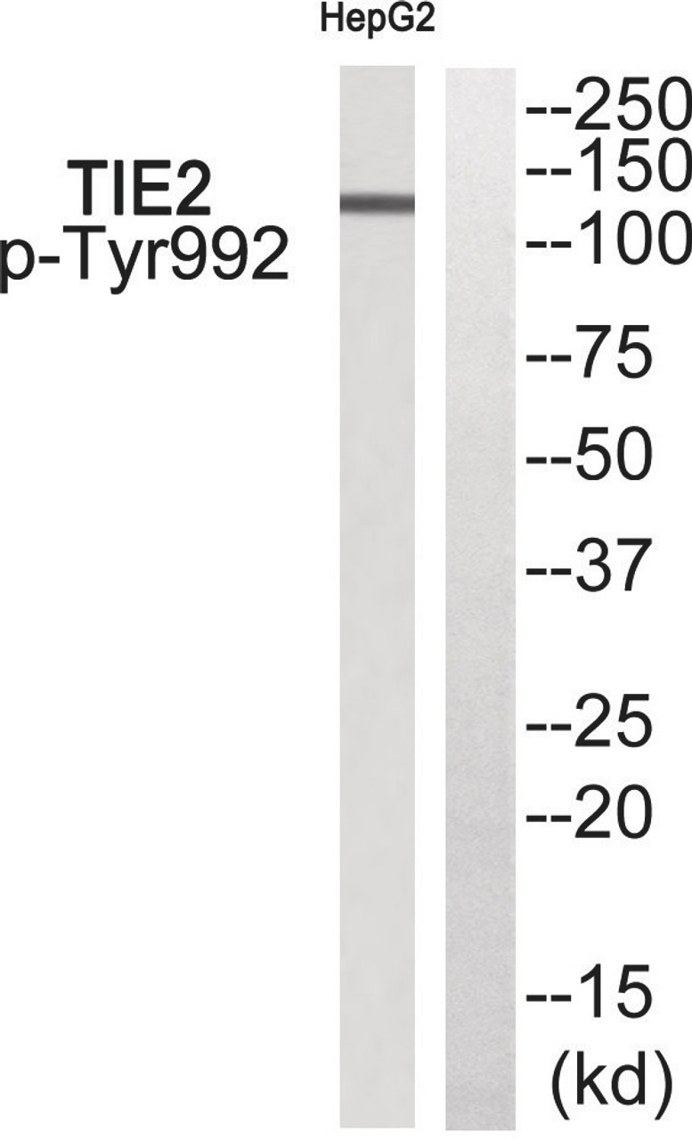 Western blot analysis of extracts from HepG2 using TIE2 (Phospho-Tyr992) Antibody. The lane on the right is treated with the antigen-specific peptide.