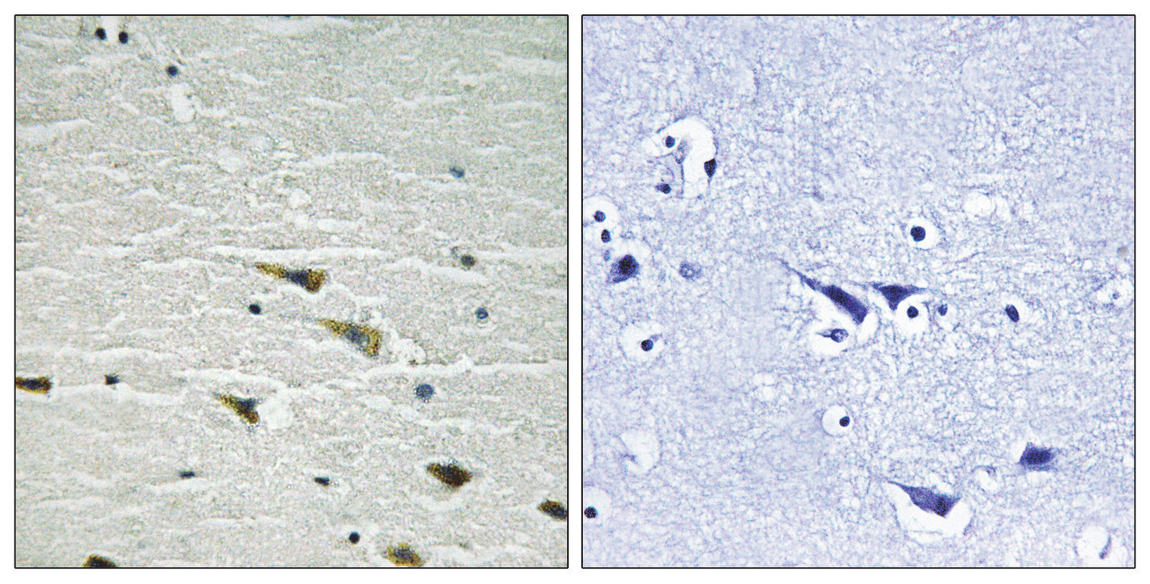 Immunohistochemical analysis of paraffin-embedded human brain tissue using Trk A (Phospho-Tyr757) antibody (left) or the same antibody preincubated with blocking peptide (right) .