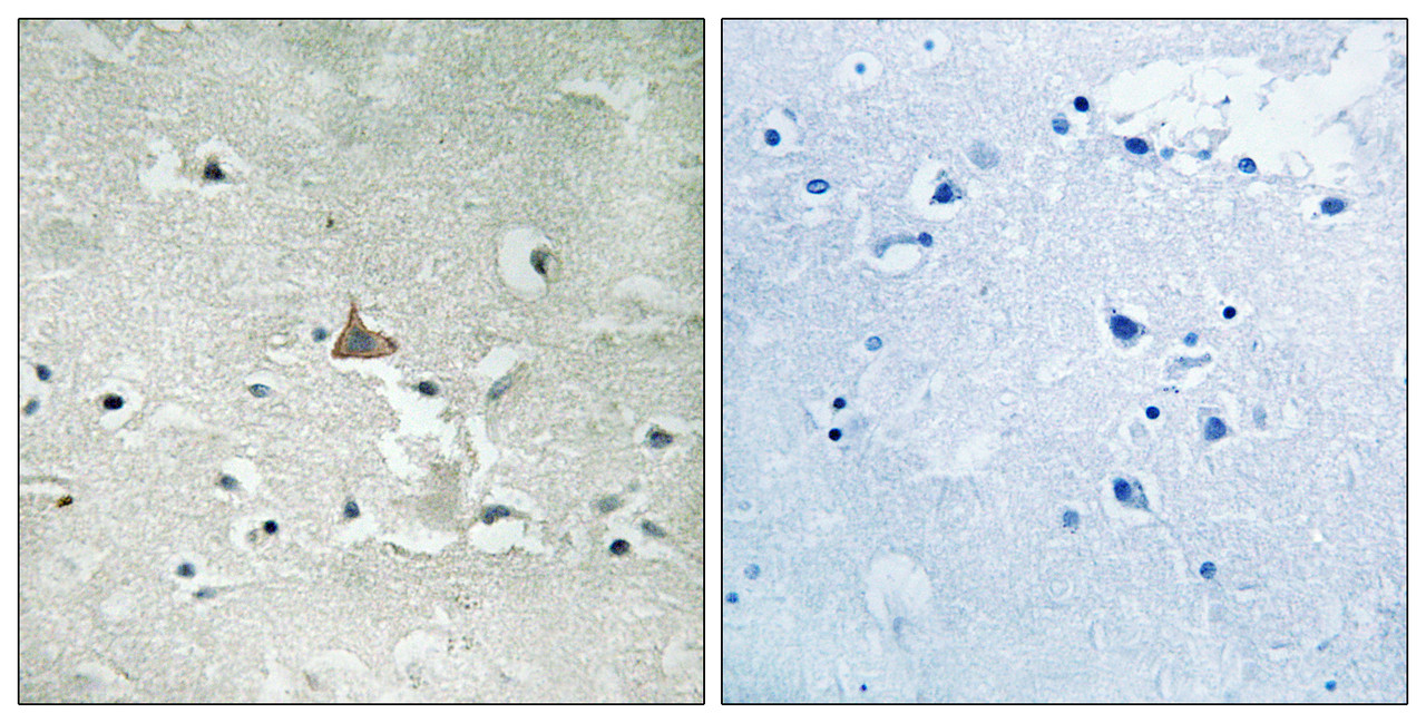 Immunohistochemical analysis of paraffin-embedded human brain tissue using Trk B (Phospho-Tyr706/Tyr707) antibody (left) or the same antibody preincubated with blocking peptide (right) .