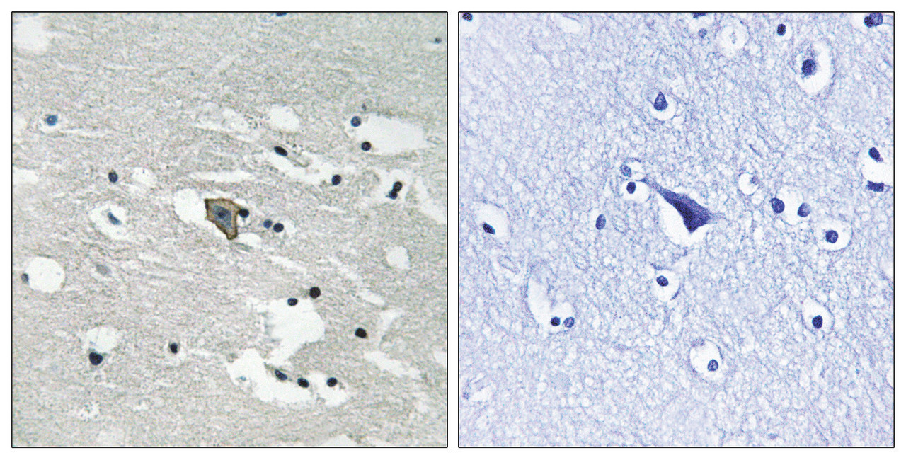 Immunohistochemical analysis of paraffin-embedded human brain tissue using VEGFR1 (Phospho-Tyr1048) antibody (left) or the same antibody preincubated with blocking peptide (right) .