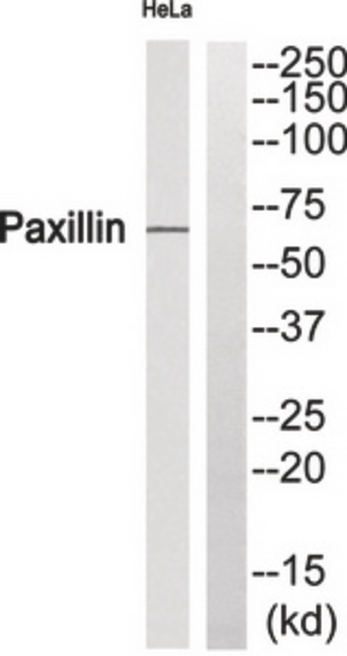 Western blot analysis of extracts from HeLa and JK using Paxillin (Phospho-Ser272) Antibody. The lane on the right is treated with the antigen-specific peptide.