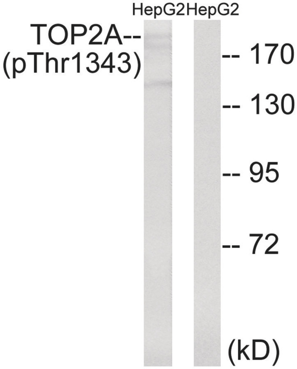 Western blot analysis of extracts from HepG2 cells treated with Ca2+ using TOP2A (Phospho-Thr1343) Antibody. The lane on the right is treated with the antigen-specific peptide.