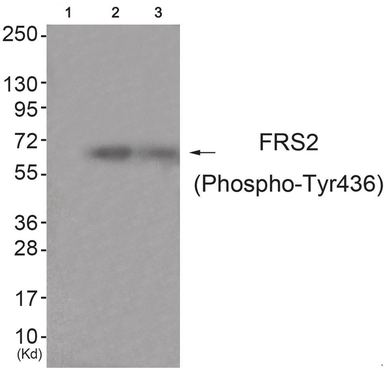 Western blot analysis of extracts from HuvEc cells (Lane 2) and JK cells (Lane 3) , using FRS2 (Phospho-Tyr436) Antibody. The lane on the left is treated with antigen-specific peptide.