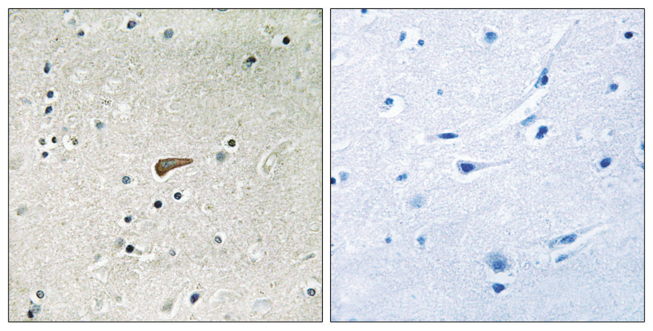 Immunohistochemical analysis of paraffin-embedded human brain tissue using FRS2 (Phospho-Tyr436) antibody (left) or the same antibody preincubated with blocking peptide (right) .