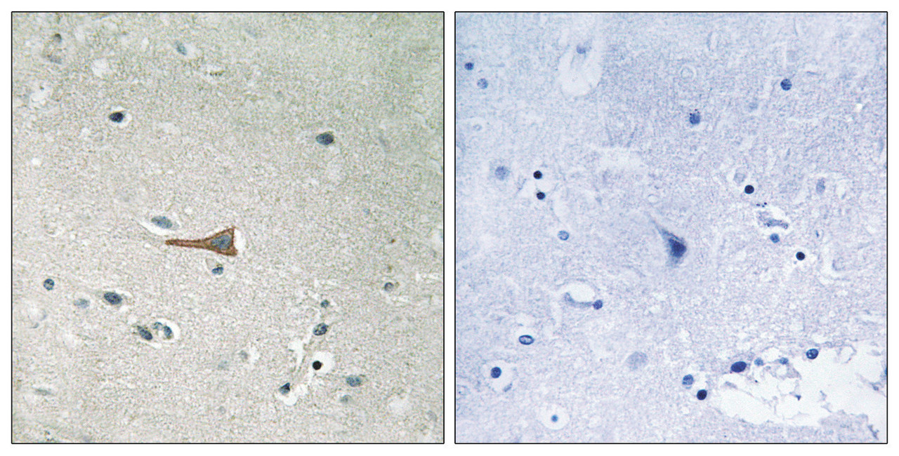 Immunohistochemical analysis of paraffin-embedded human brain tissue using DDR1 (Phospho-Tyr513) antibody (left) or the same antibody preincubated with blocking peptide (right) .