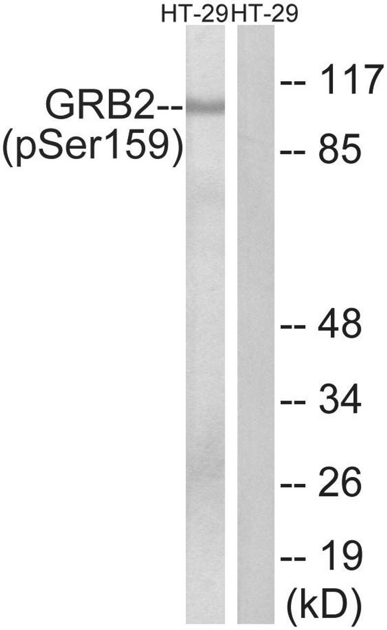 Western blot analysis of extracts from HT-29 cells treated with serum using GRB2 (Phospho-Ser159) Antibody. The lane on the right is treated with the antigen-specific peptide.