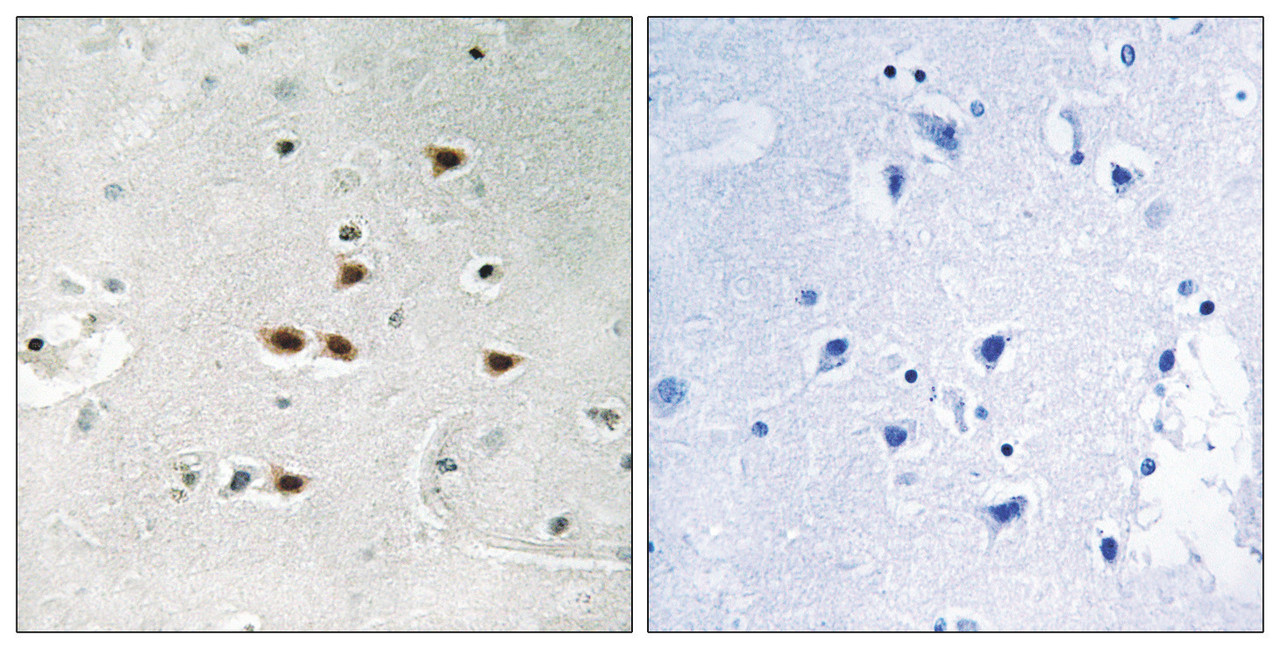 Immunohistochemical analysis of paraffin-embedded human brain tissue using ITCH (Phospho-Tyr420) antibody (left) or the same antibody preincubated with blocking peptide (right) .