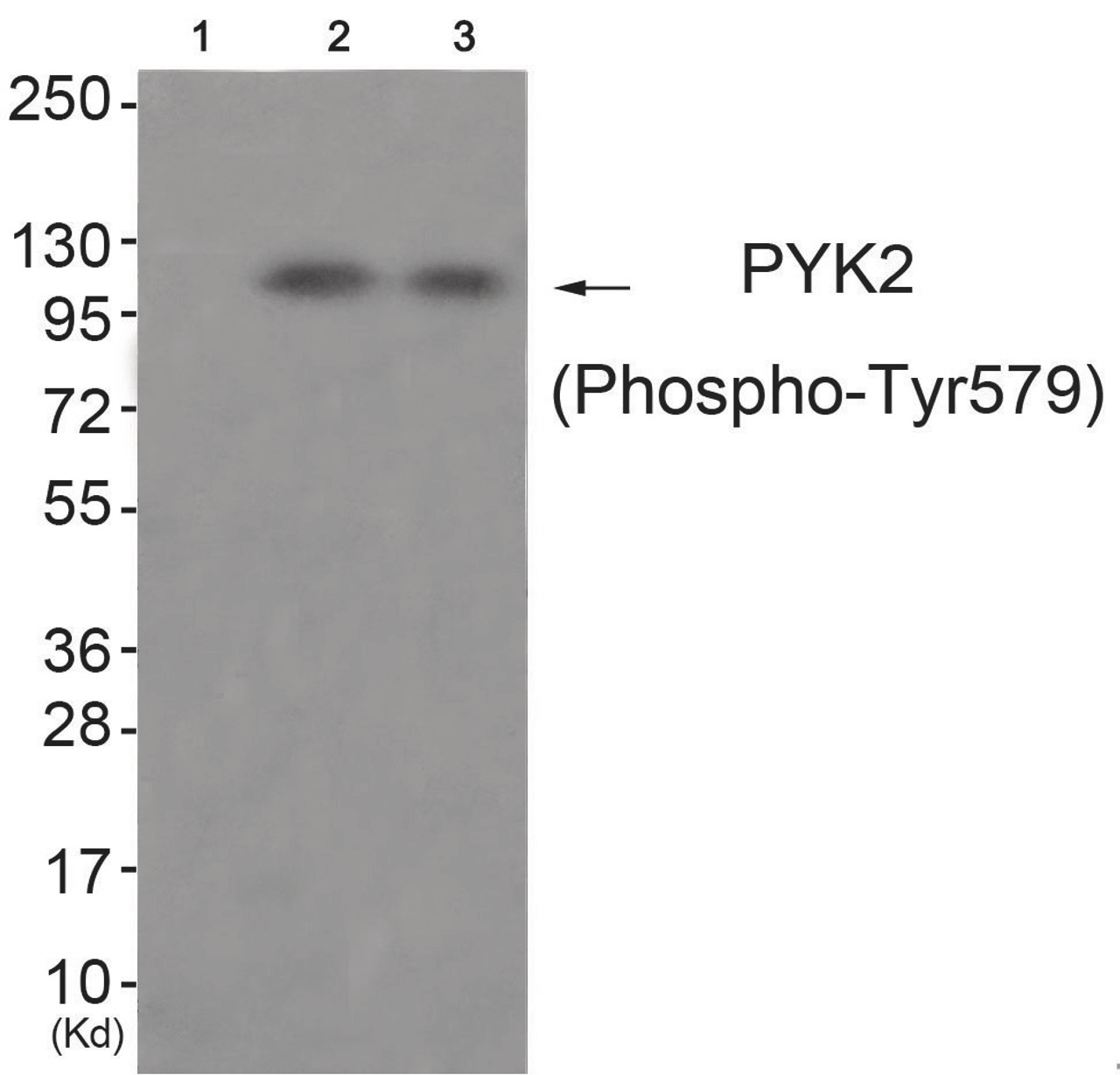 Western blot analysis of extracts from 3T3 cells (Lane 2) and HepG2 cells (Lane 3) , using PYK2 (Phospho-Tyr579) Antibody. The lane on the left is treated with antigen-specific peptide.