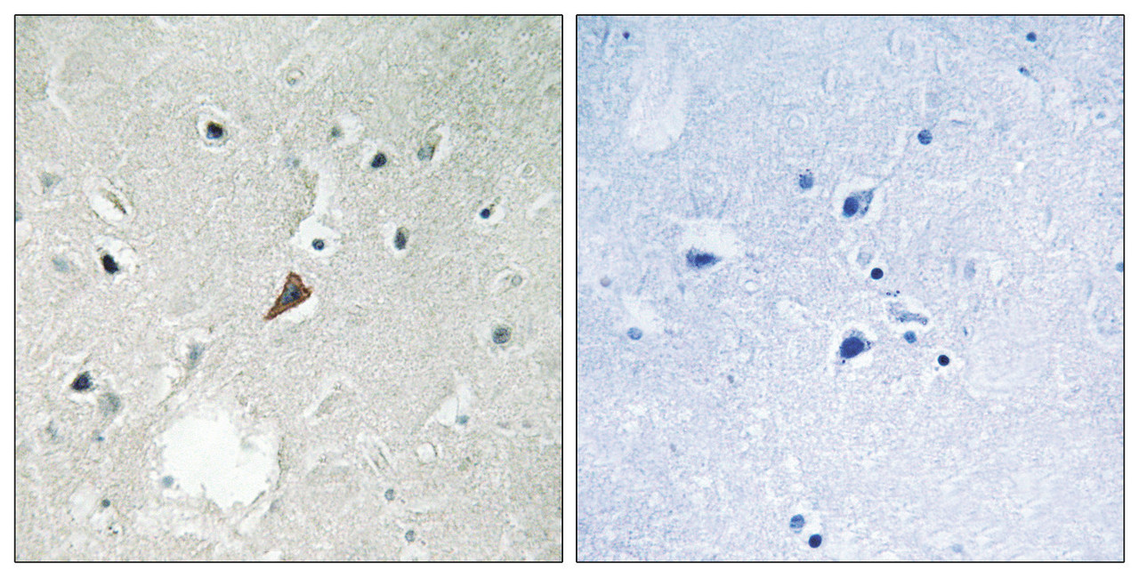 Immunohistochemical analysis of paraffin-embedded human brain tissue using PYK2 (Phospho-Tyr579) antibody (left) or the same antibody preincubated with blocking peptide (right) .