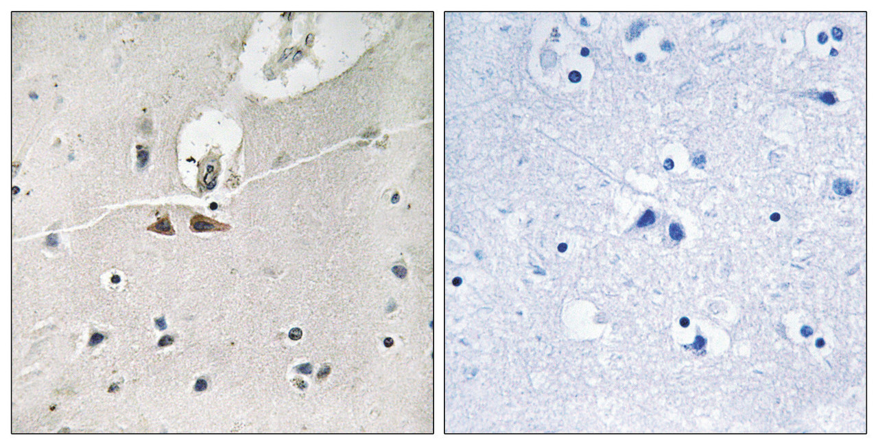 Immunohistochemical analysis of paraffin-embedded human brain tissue using Ephrin B1/B2/B3 (Phospho-Tyr324) antibody (left) or the same antibody preincubated with blocking peptide (right) .