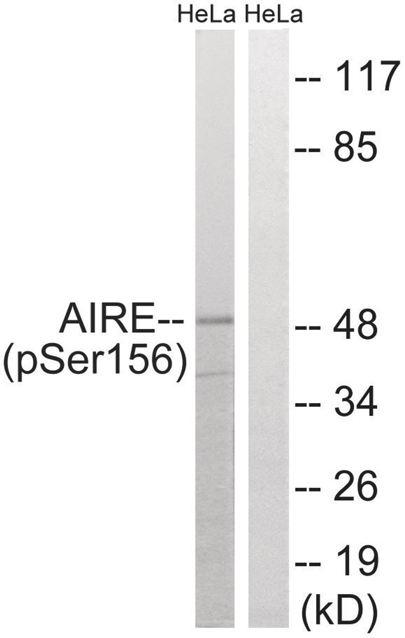 Western blot analysis of extracts from HeLa cells treated with Hu using AIRE (Phospho-Ser156) Antibody. The lane on the right is treated with the antigen-specific peptide.