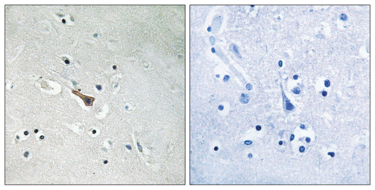 Immunohistochemical analysis of paraffin-embedded human brain tissue using APLP2 (Phospho-Tyr755) antibody (left) or the same antibody preincubated with blocking peptide (right) .