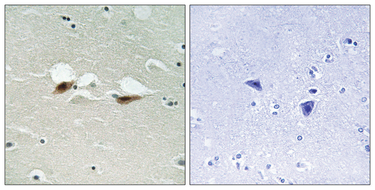 Immunohistochemical analysis of paraffin-embedded human brain tissue using ATF-2 (Phospho-Ser472) antibody (left) or the same antibody preincubated with blocking peptide (right) .