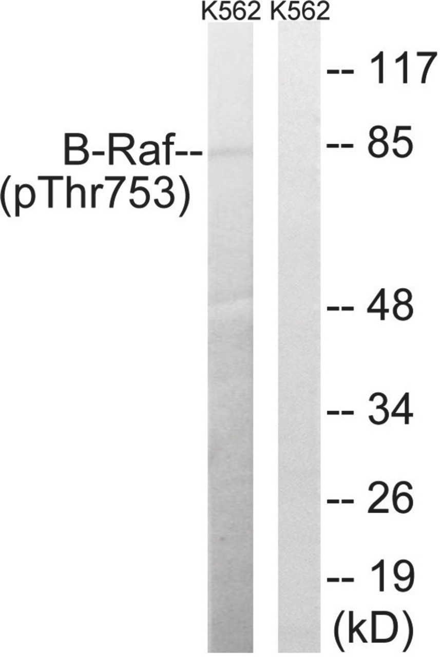 Western blot analysis of extracts from K562 cells treated with EGF using B-Raf (Phospho-Thr753) Antibody. The lane on the right is treated with the antigen-specific peptide.