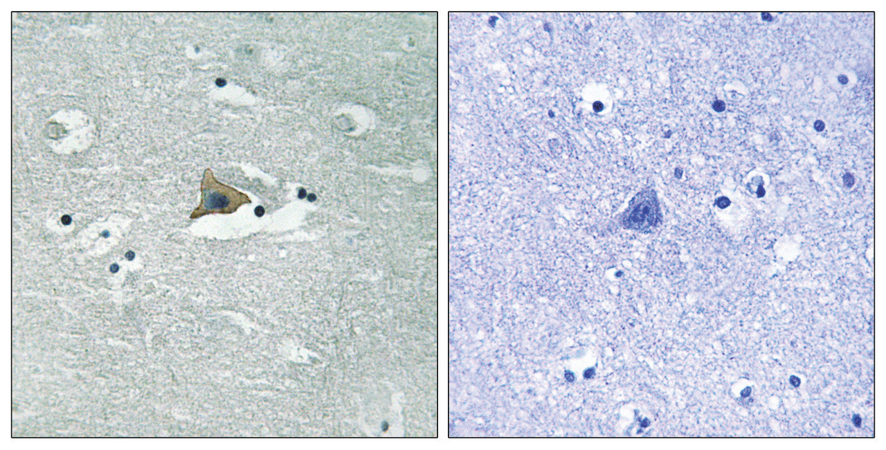 Immunohistochemical analysis of paraffin-embedded human brain tissue using Claudin 5 (Phospho-Tyr217) antibody (left) or the same antibody preincubated with blocking peptide (right) .