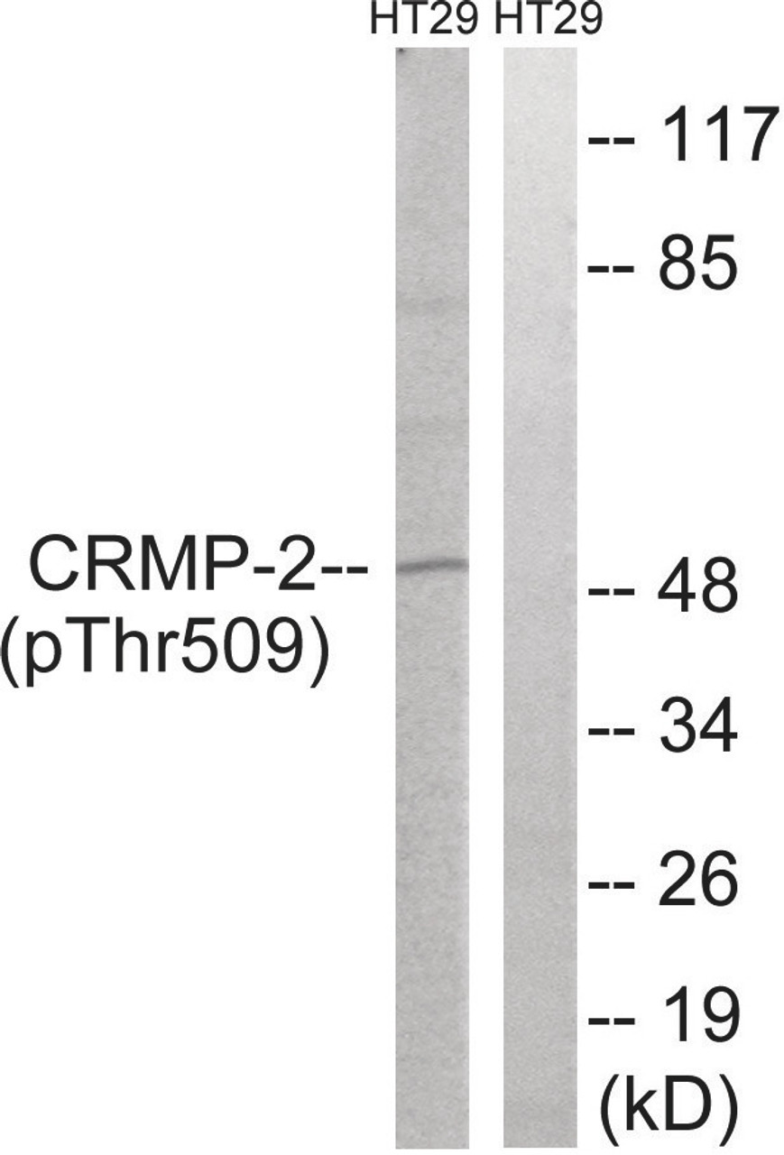 Western blot analysis of extracts from HT-29 cells treated with heat shock using CRMP-2 (Phospho-Thr509) Antibody. The lane on the right is treated with the antigen-specific peptide.