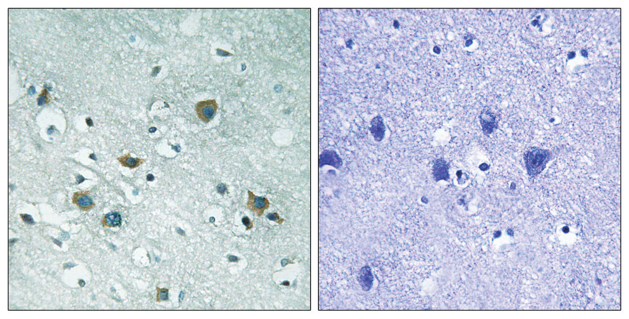 Immunohistochemical analysis of paraffin-embedded human brain tissue using CRMP-2 (Phospho-Thr509) antibody (left) or the same antibody preincubated with blocking peptide (right) .