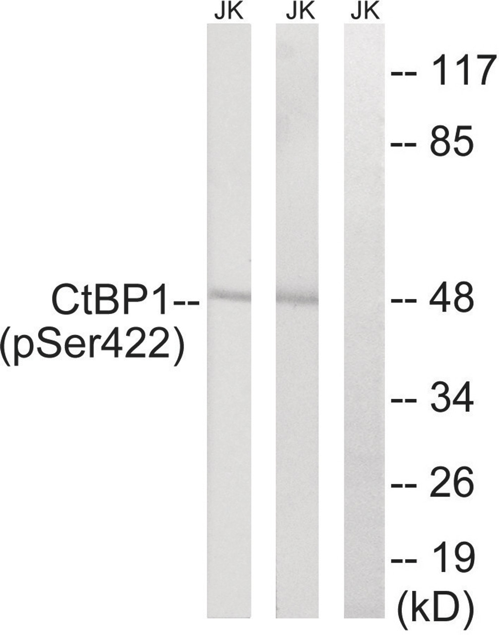 Western blot analysis of extracts from Jurkat cells treated with TNF using CtBP1 (Phospho-Ser422) Antibody. The lane on the right is treated with the antigen-specific peptide.