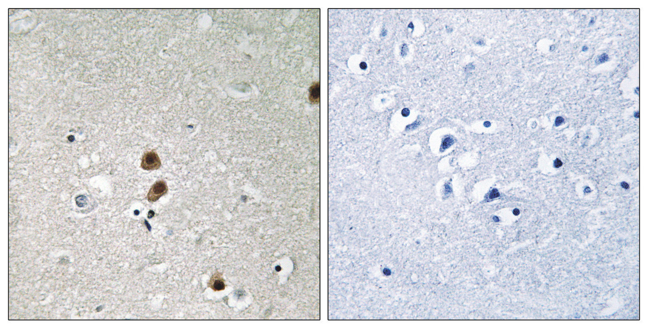 Immunohistochemical analysis of paraffin-embedded human brain tissue, using CtBP1 (Phospho-Ser422) antibody (left) or the same antibody preincubated with blocking peptide (right) .