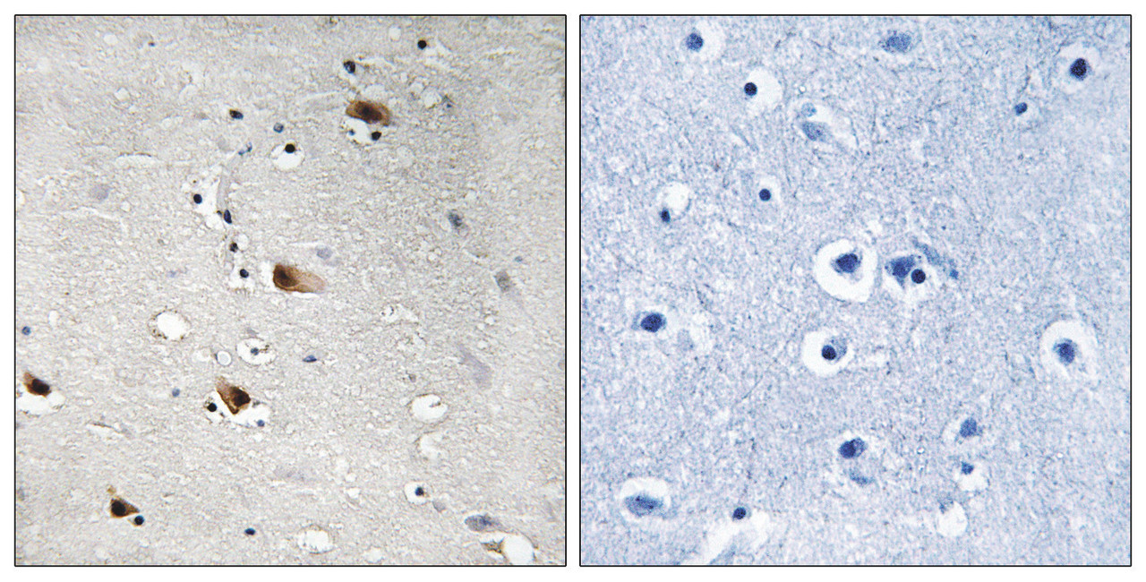 Immunohistochemical analysis of paraffin-embedded human brain tissue using E2A (Phospho-Thr355) antibody (left) or the same antibody preincubated with blocking peptide (right) .