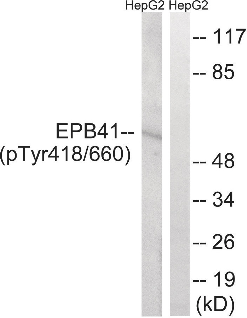 Western blot analysis of extracts from HepG2 cells treated with PMA using EPB41 (Phospho-Tyr660/418) Antibody. The lane on the right is treated with the antigen-specific peptide.