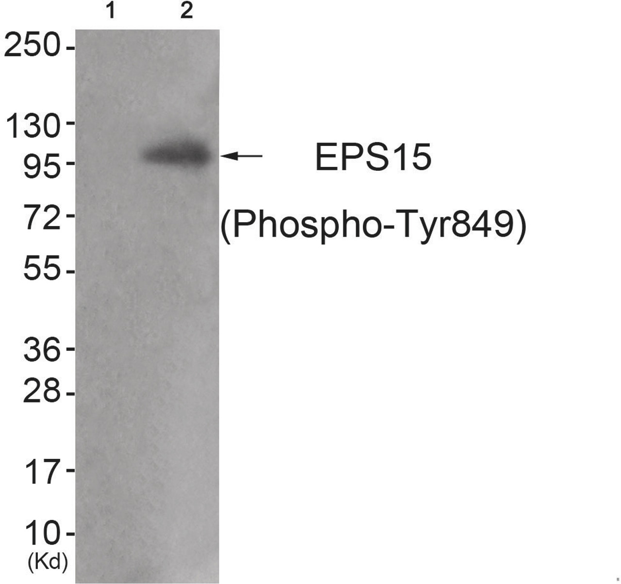 Western blot analysis of extracts from JK cells (Lane 2) , using EPS15 (Phospho-Tyr849) Antibody. The lane on the left is treated with antigen-specific peptide.
