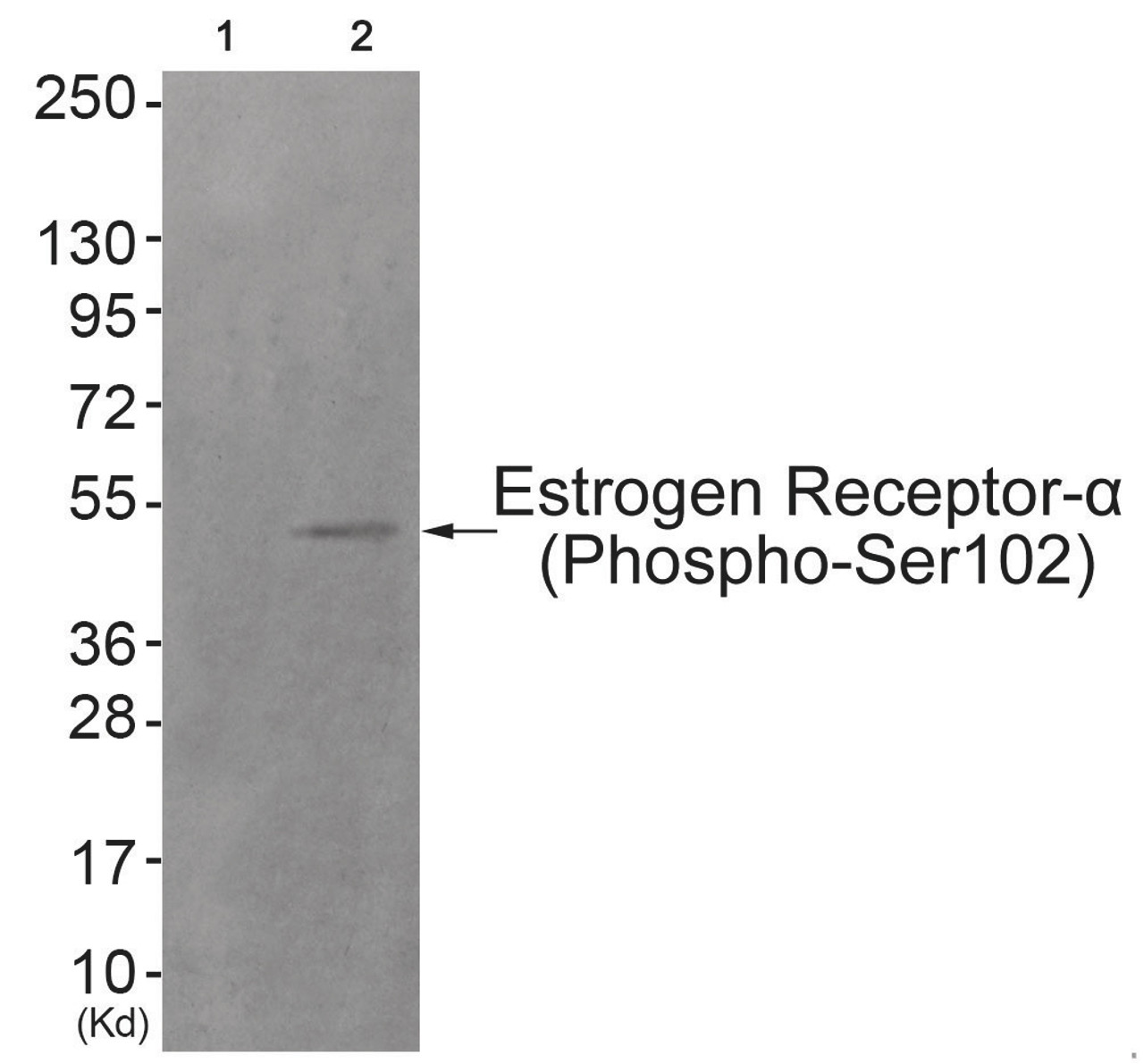 Western blot analysis of extracts from HuvEc cells (Lane 2) , using Estrogen Receptor-alpha (Phospho-Ser102) Antibody. The lane on the left is treated with antigen-specific peptide.