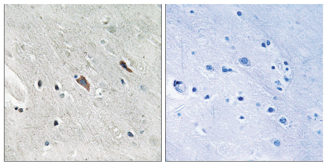 Immunohistochemical analysis of paraffin-embedded human brain tissue using Gab2 (Phospho-Tyr643) antibody (left) or the same antibody preincubated with blocking peptide (right) .