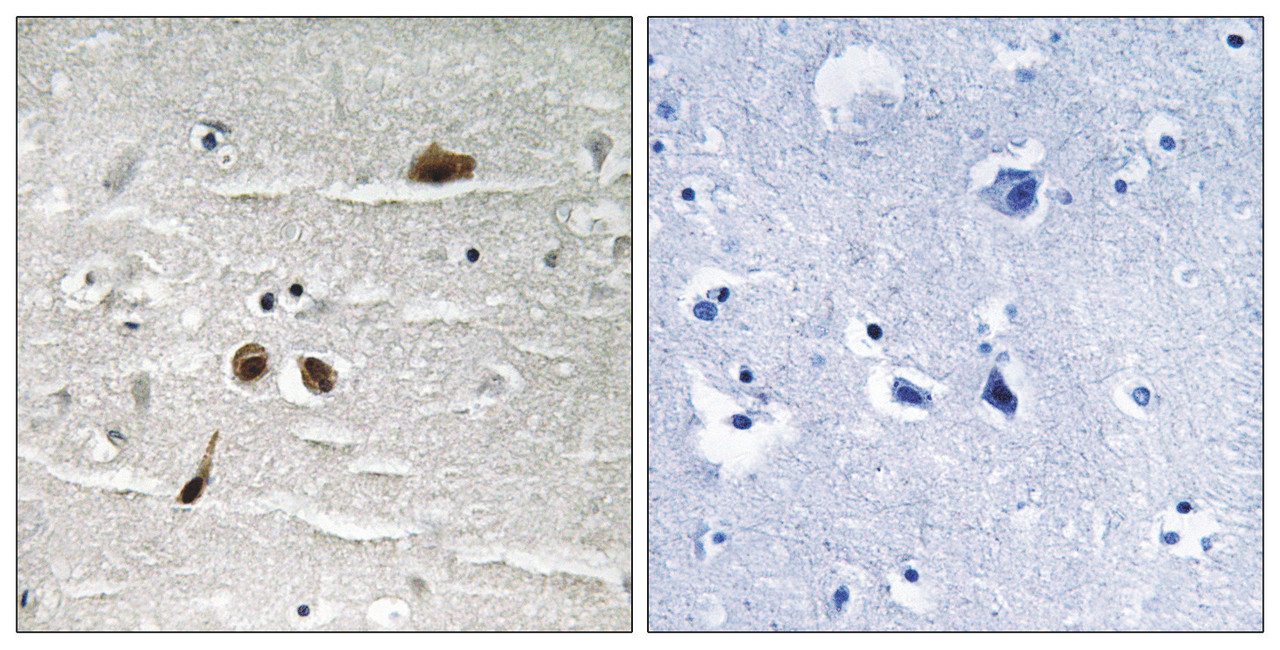 Immunohistochemical analysis of paraffin-embedded human brain tissue using MDC1 (Phospho-Ser513) antibody (left) or the same antibody preincubated with blocking peptide (right) .