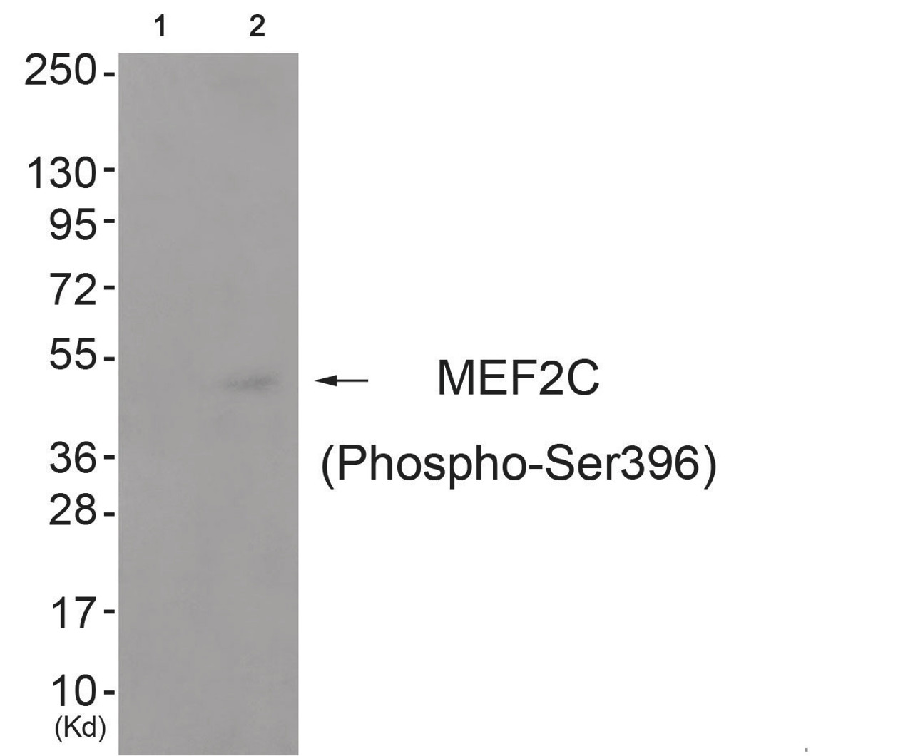 Western blot analysis of extracts from cos-7 cells (Lane 2) , using MEF2C (Phospho-Ser396) Antibody. The lane on the left is treated with antigen-specific peptide.