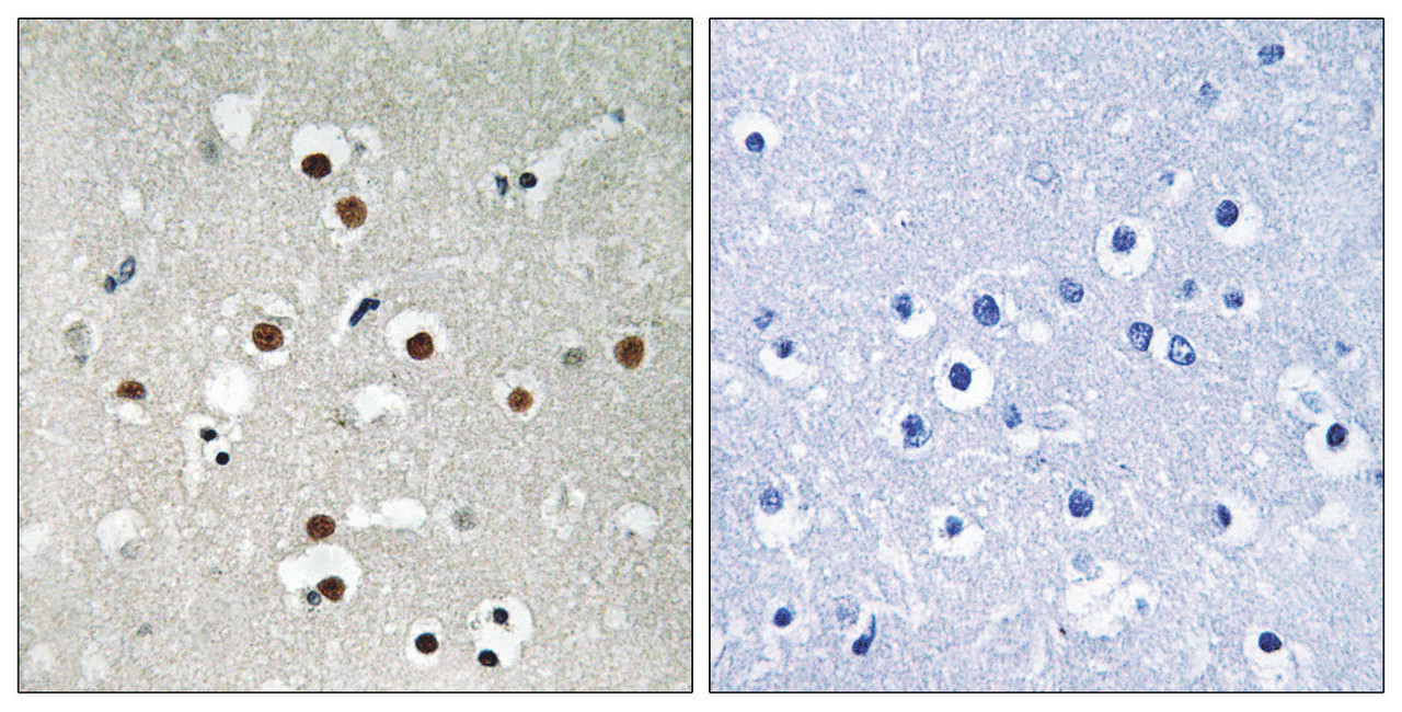 Immunohistochemical analysis of paraffin-embedded human brain tissue using MEF2C (Phospho-Ser396) antibody (left) or the same antibody preincubated with blocking peptide (right) .