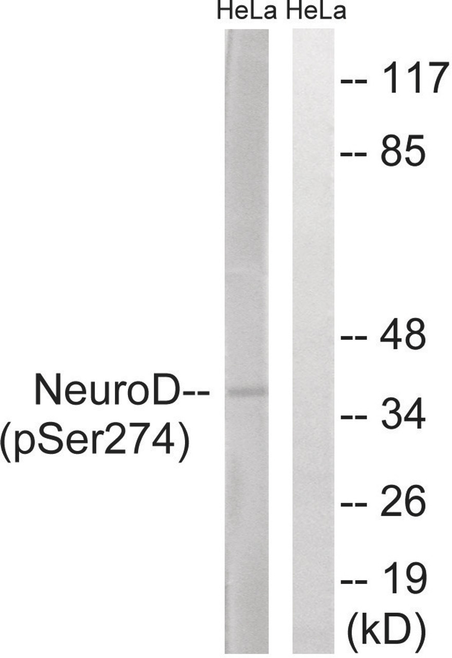 Western blot analysis of extracts from HeLa cells treated with UV using Neuro D (Phospho-Ser274) Antibody. The lane on the right is treated with the antigen-specific peptide.