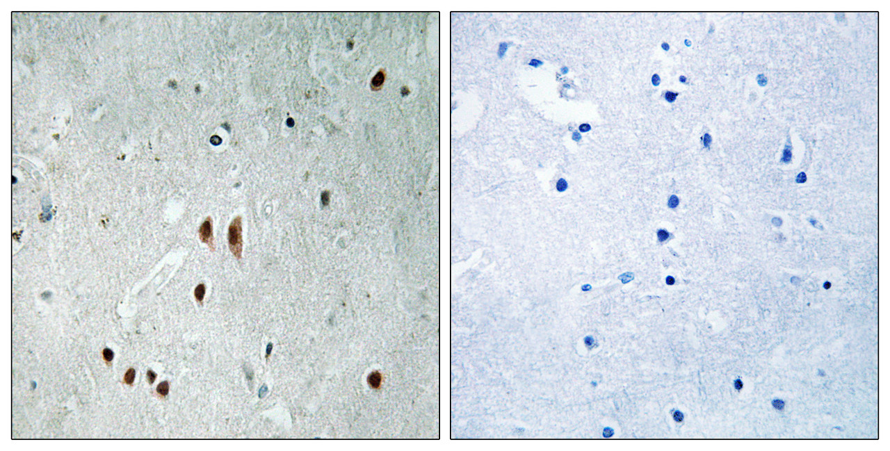 Immunohistochemical analysis of paraffin-embedded human brain tissue using CNOT2 (Phospho-Ser101) antibody (left) or the same antibody preincubated with blocking peptide (right) .