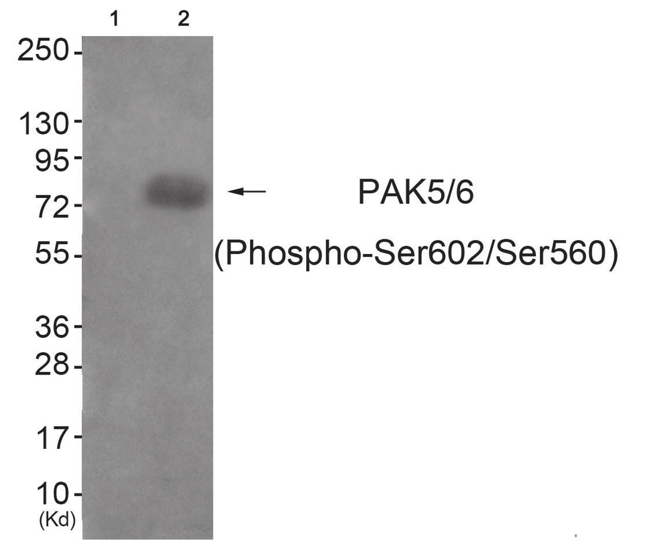 Western blot analysis of extracts from HeLa cells (Lane 2) , using PAK5/6 (Phospho-Ser602/Ser560) Antibody. The lane on the left is treated with antigen-specific peptide.