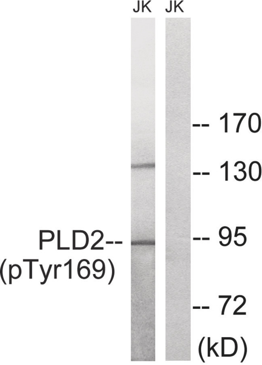 Western blot analysis of extracts from Jurkat cells treated with TNF using PLD2 (Phospho-Tyr169) Antibody. The lane on the right is treated with the antigen-specific peptide.