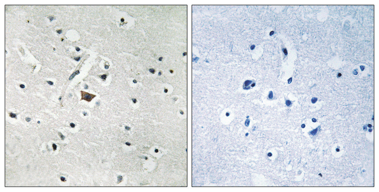 Immunohistochemical analysis of paraffin-embedded human brain tissue using PLD2 (Phospho-Tyr169) antibody (left) or the same antibody preincubated with blocking peptide (right) .