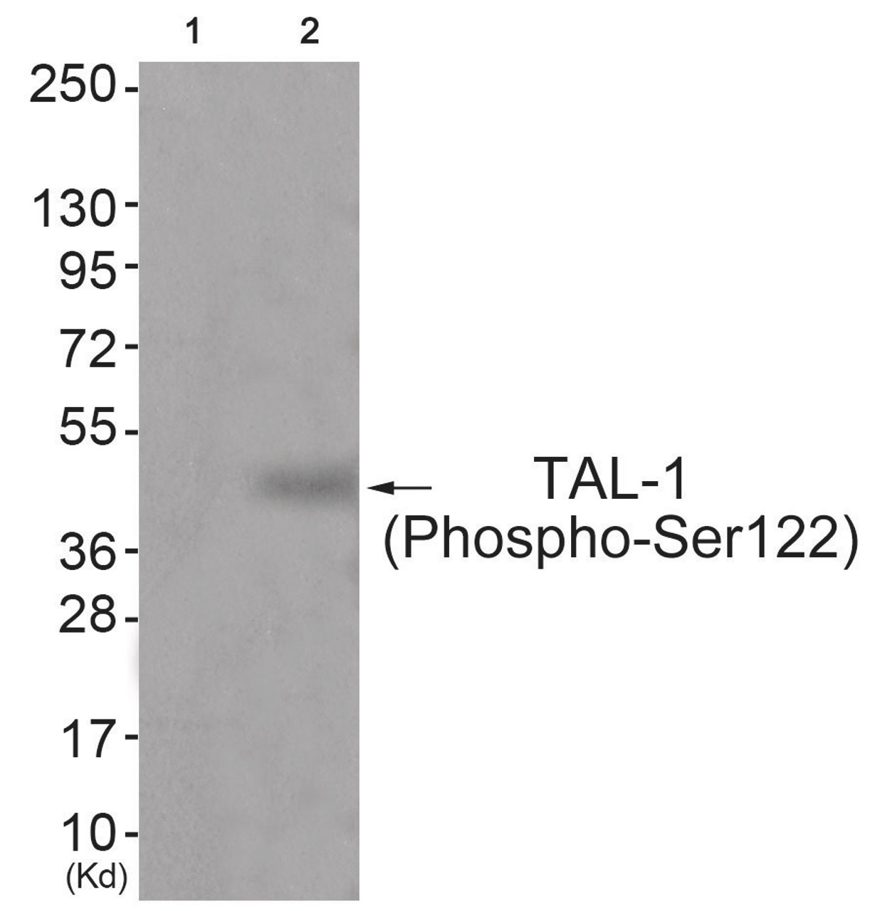 Western blot analysis of extracts from JK cells (Lane 2) , using TAL-1 (Phospho-Ser122) Antibody. The lane on the left is treated with antigen-specific peptide.