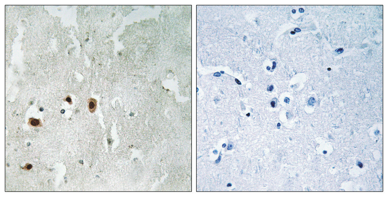 Immunohistochemical analysis of paraffin-embedded human brain tissue using Tip60 (Phospho-Ser90) antibody (left) or the same antibody preincubated with blocking peptide (right) .