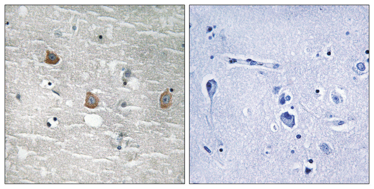 Immunohistochemical analysis of paraffin-embedded human brain tissue using TOB1 (Phospho-Ser164) antibody (left) or the same antibody preincubated with blocking peptide (right) .