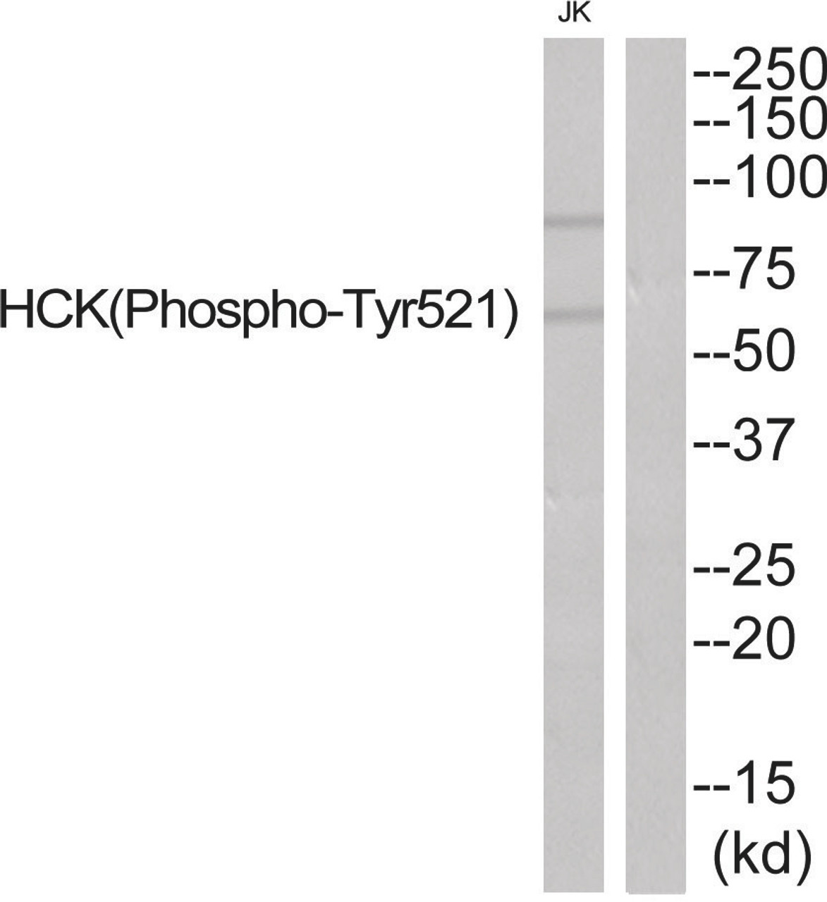 Western blot analysis of extracts from JurKat cells using HCK (Phospho-Tyr521) Antibody. The lane on the right is treated with the antigen-specific peptide.