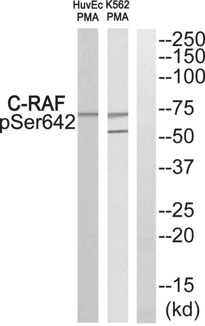 Western blot analysis of extracts from HuvEc cells and K562 cells treated with PMA using C-RAF (Phospho-Ser642) Antibody. The lane on the right is treated with the antigen-specific peptide.
