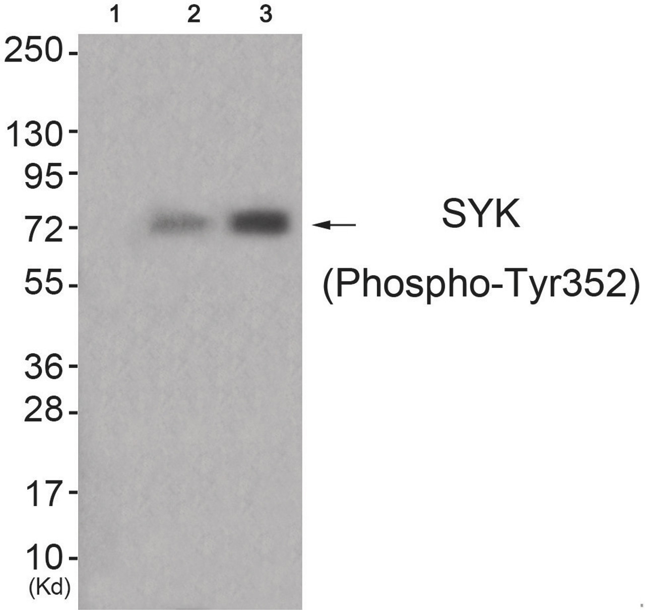 Western blot analysis of extracts from HuvEc cells (Lane 2) and HepG2 cells (Lane 3) , using SYK (Phospho-Tyr352) Antibody. The lane on the left is treated with antigen-specific peptide.