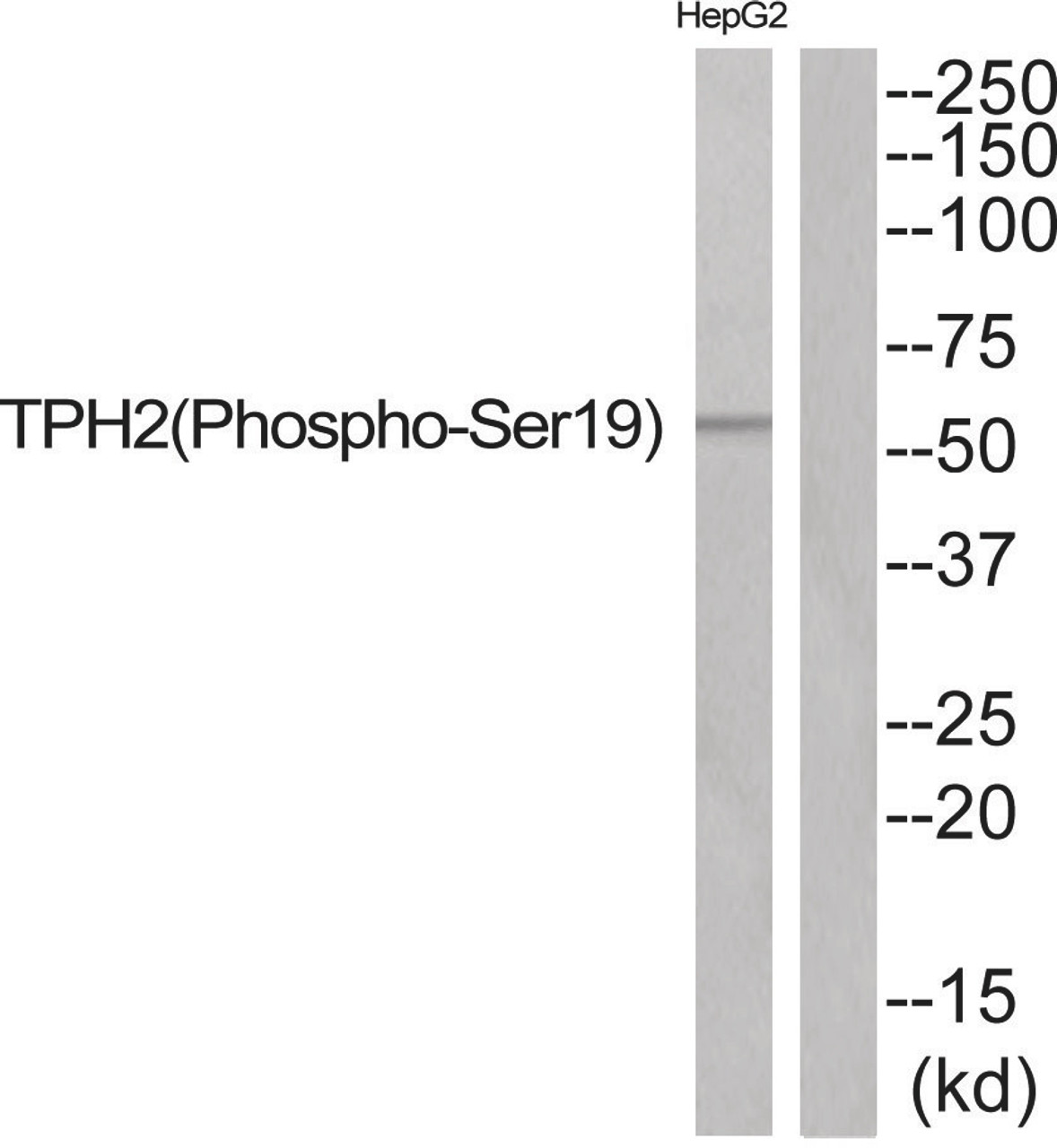 Western blot analysis of extracts from HepG2 cells using TPH2 (Phospho-Ser19) Antibody. The lane on the right is treated with the antigen-specific peptide.