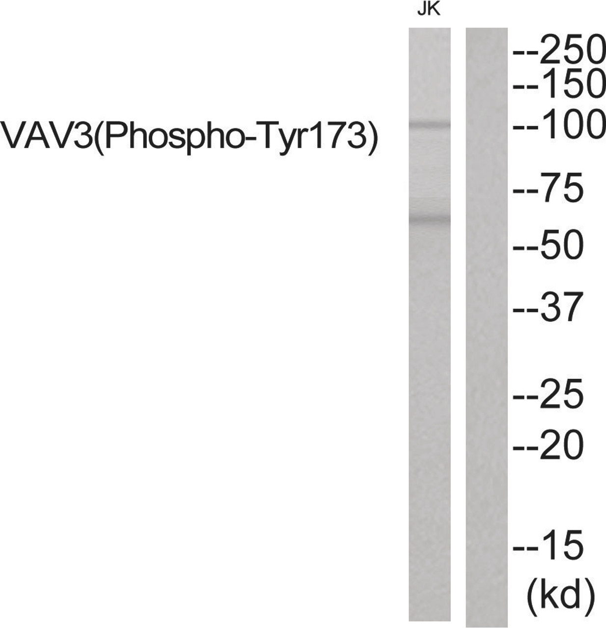 Western blot analysis of extracts from JK cells using VAV3 (Phospho-Tyr173) Antibody. The lane on the right is treated with the antigen-specific peptide.