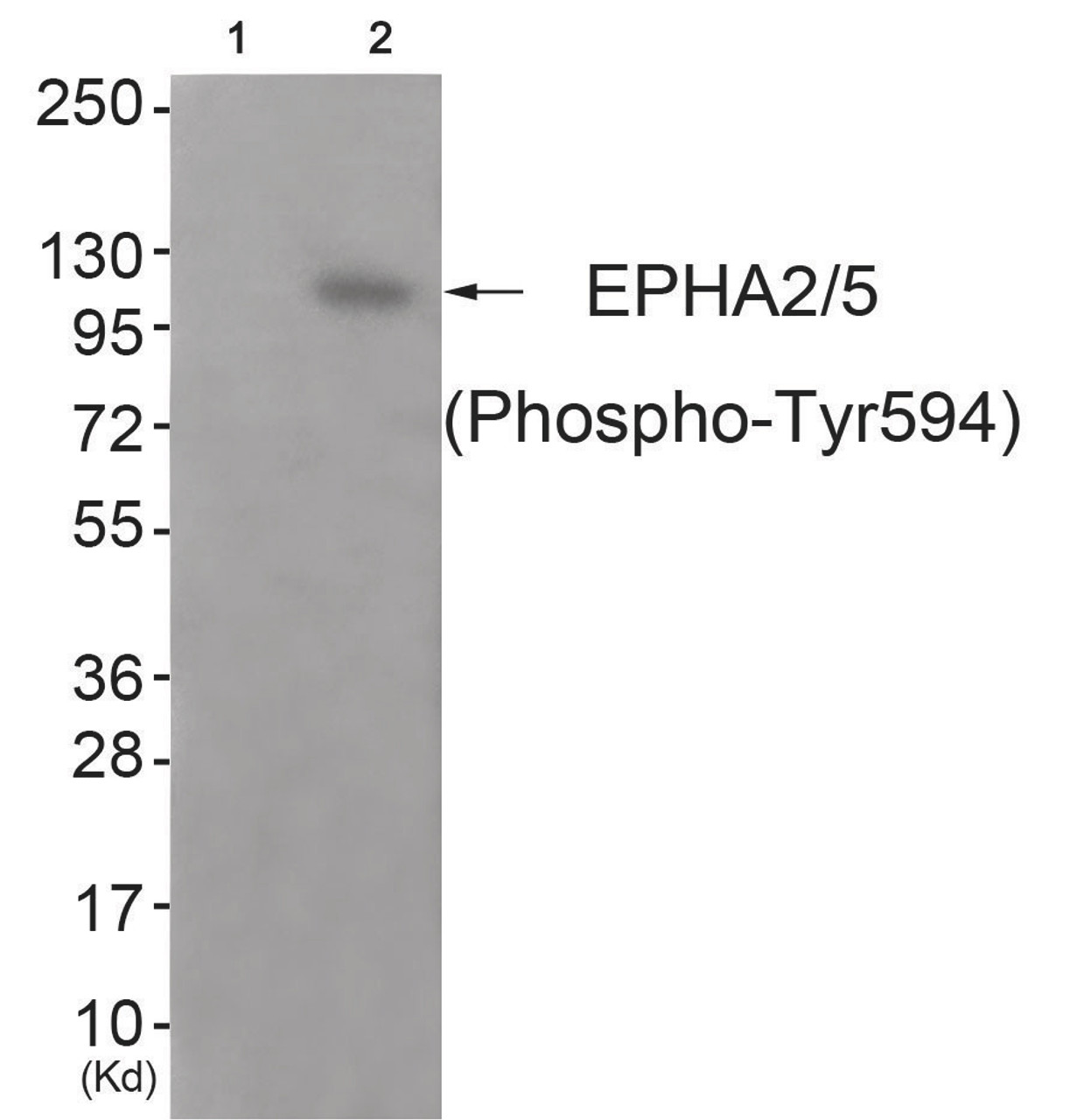 Western blot analysis of extracts from JK cells (Lane 2) , using EPHA2/5 (Phospho-Tyr594) Antibody. The lane on the left is treated with antigen-specific peptide.